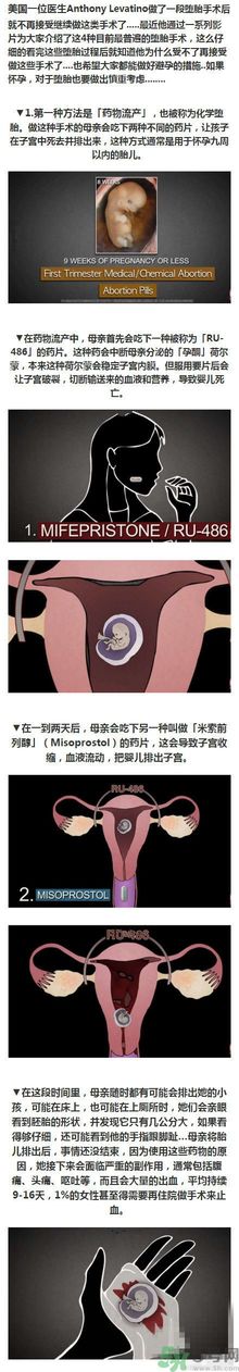 墮胎手術(shù)的可怕細(xì)節(jié)