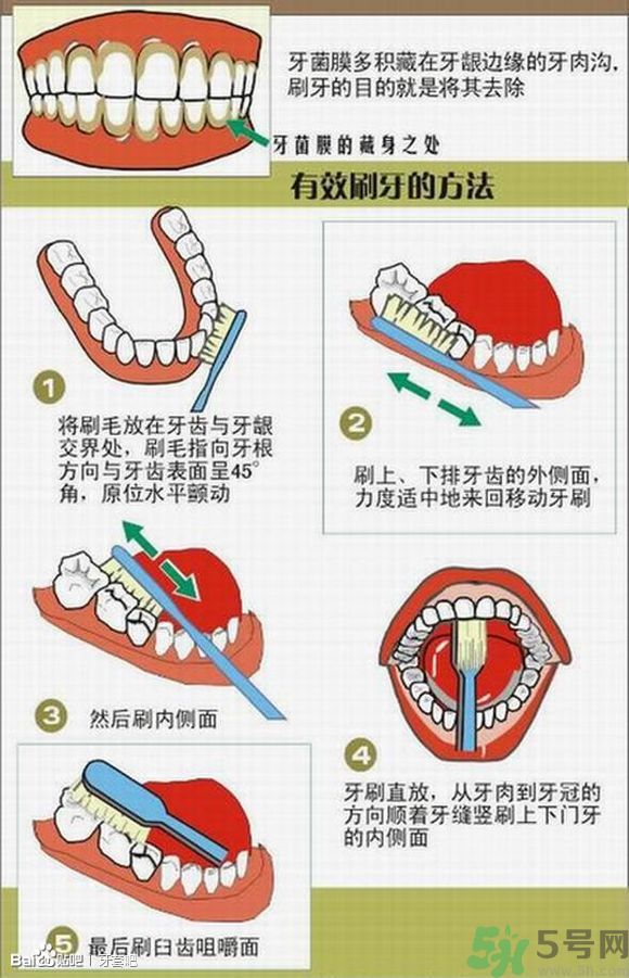 18歲還能戴牙套嗎？戴牙套真的能瘦臉改變臉型嗎？