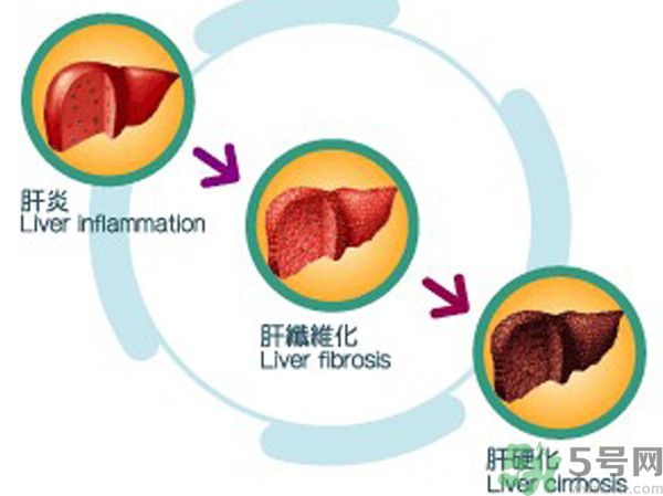 在外面吃飯會得乙肝嗎？在食堂吃飯會得乙肝嗎？