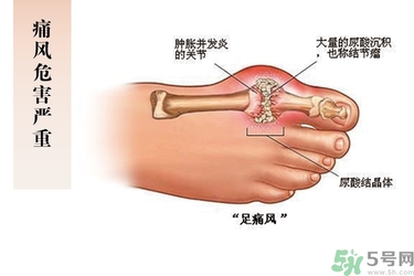 痛風(fēng)可以吃木耳嗎?痛風(fēng)不能吃什么