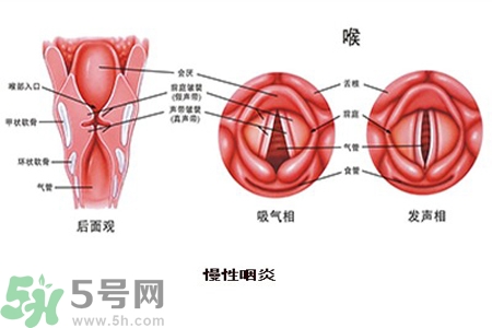 慢性咽炎是什么？慢性咽炎的癥狀有哪些？