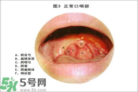 慢性咽炎的治療方法？慢性咽炎的藥物治療？