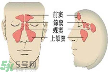 鼻竇炎是什么？鼻竇炎的癥狀有哪些？