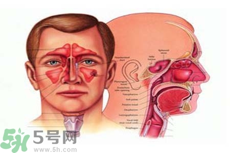 鼻竇炎是什么？鼻竇炎的癥狀有哪些？