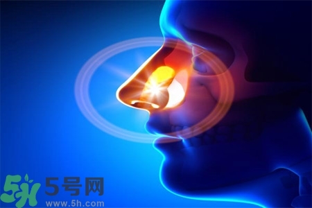 鼻竇炎的高發(fā)人群？如何預(yù)防鼻竇炎？