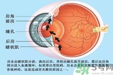 青光眼是什么？青光眼癥狀有什么？