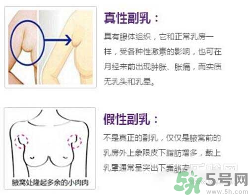 副乳是什么？副乳的危害