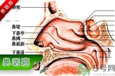 鼻咽癌是什么？鼻咽癌的癥狀有哪些？