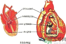 先天性心臟病可以用藥物治療嗎？