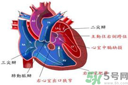 先天性心臟病需要注意什么？