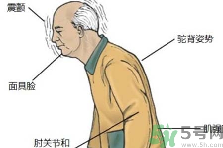 帕金森的易發(fā)人群有哪些？如何預(yù)防帕金森？