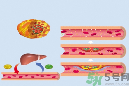 膽固醇對(duì)人體有傷害嗎？膽固醇是什么？