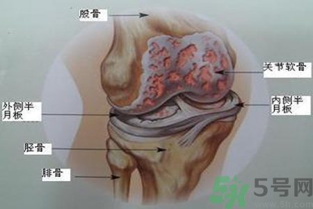 預(yù)防骨病需要注意哪些姿勢？秋季預(yù)防骨病的方法有哪些？