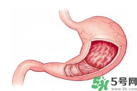 急性腸胃炎哪些食物不可以吃？急性腸胃炎不能吃的水果有？