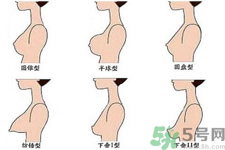 ?女性乳房下垂的原因是什么？女性乳房下垂的分類有哪些？