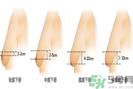 胸部松弛的原因是什么？胸部松弛該怎么辦？