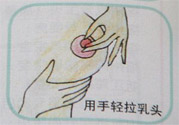 乳頭內(nèi)陷怎么回事？乳頭內(nèi)陷的原因是什么？