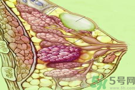 乳房屋硬塊有疼痛感怎么回事？乳房屋硬塊有疼痛感怎么辦？