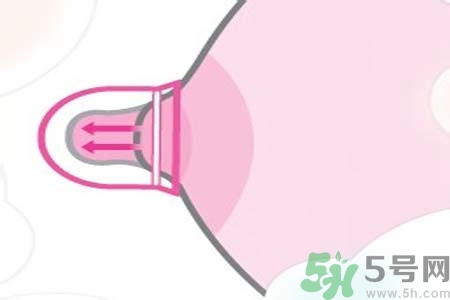 乳頭內(nèi)陷能不能喂奶？乳頭凹陷怎樣哺乳？