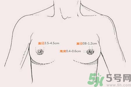 乳頭內(nèi)陷能不能喂奶？乳頭凹陷怎樣哺乳？