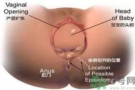 女性陰道松弛的原因是什么？女性陰道松弛怎么辦？