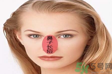 鼻翼長(zhǎng)痘痘怎么辦？鼻翼長(zhǎng)痘解決方法有哪些？