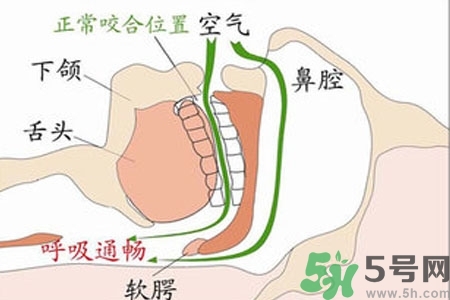 鼻子紅是什么原因？鼻子紅怎么辦？