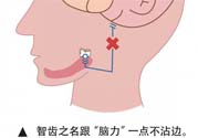 長(zhǎng)智齒疼痛怎么辦？長(zhǎng)智齒牙齦腫了怎么辦？