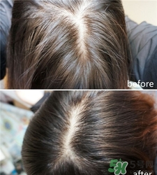 hairmax激光生發(fā)梳怎么用?hairmax激光生發(fā)梳使用心得