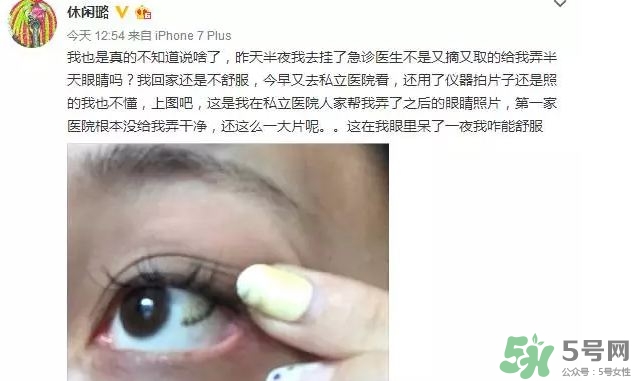 隱形眼鏡會(huì)碎嗎?隱形眼鏡碎在眼睛里怎么辦?