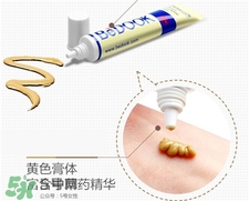 比度克拔毒膏有激素嗎?比度克拔毒膏有用嗎?