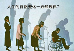 哪些人容易得骨質(zhì)疏松癥？骨質(zhì)疏松的高發(fā)人群有哪些？