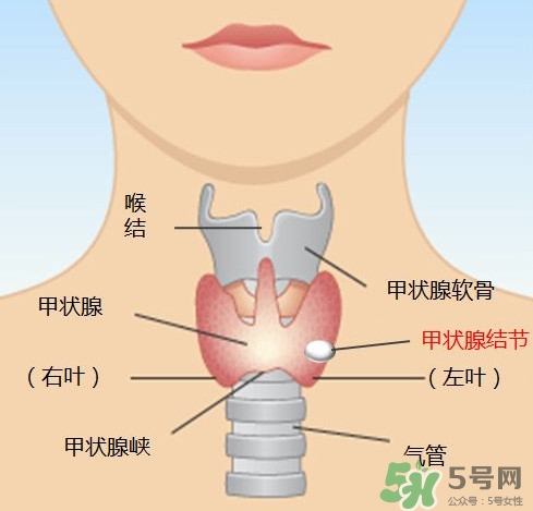 甲狀腺結節(jié)如何治療 甲狀腺結節(jié)的癥狀