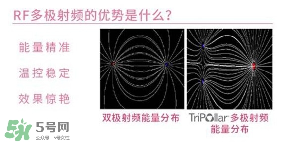 tripollar stop怎么樣？tripollar pose好用嗎