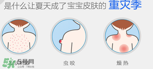 妙思樂爽膚水好用嗎？妙思樂爽膚水能去痱嗎？