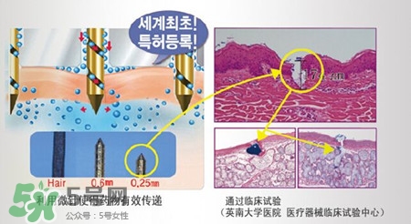 珠兒麗蚊子針好用嗎？珠兒麗蚊子針副作用