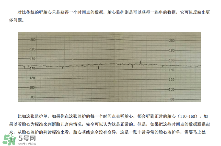 胎心儀有必要買(mǎi)嗎？胎心儀是不是必需品？