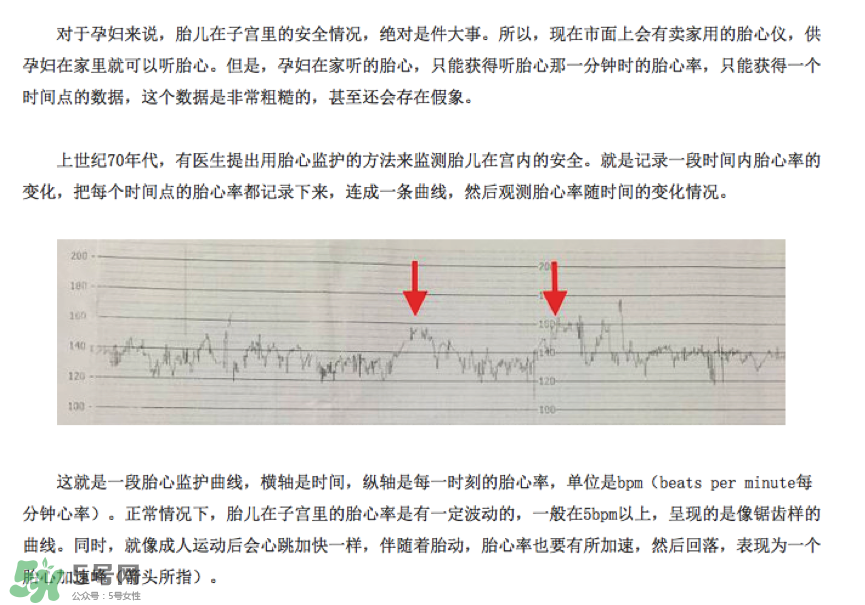 胎心儀有必要買(mǎi)嗎？胎心儀是不是必需品？