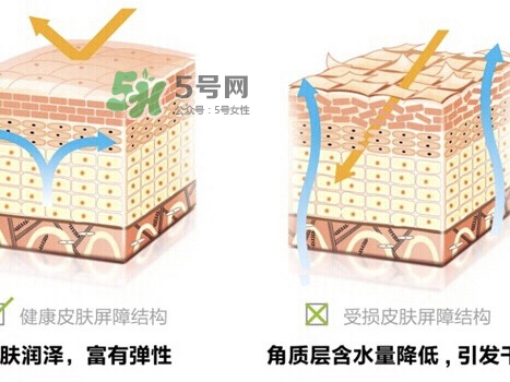 肌膚屏障受損的原因是什么 肌膚屏障受損用什么護(hù)膚品