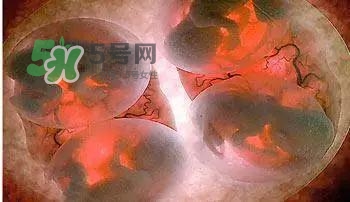 多胞胎是怎么生產(chǎn)的？多胞胎應(yīng)選擇什么分娩方式