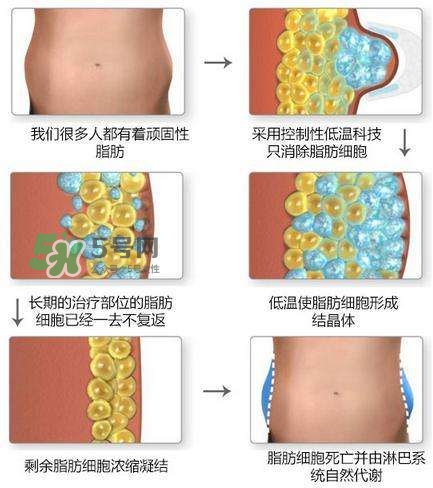 酷塑溶脂效果對比圖片 酷塑溶脂全過程記錄