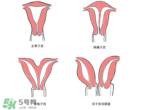 雙子宮是什么意思？雙子宮可以順產(chǎn)嗎？