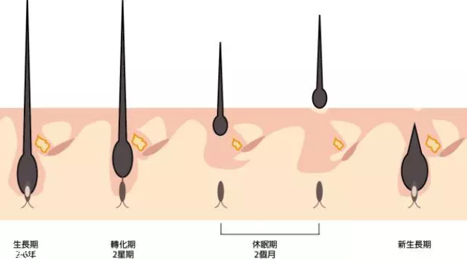 頭發(fā)為什么會(huì)掉？毛囊想休息了