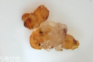 桃膠可以用開水泡嗎？用開水泡桃膠好嗎？