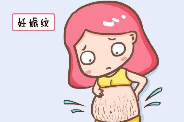 妊娠紋可以完全修復嗎 怎樣去除妊辰紋妙招