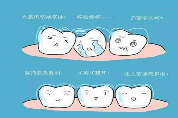 牙齒矯正會(huì)反彈嗎 牙齒矯正會(huì)改變嘴唇嗎