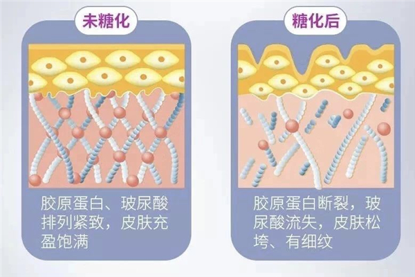 肌膚抗糖化有什么作用 肌膚抗糖化什么意思