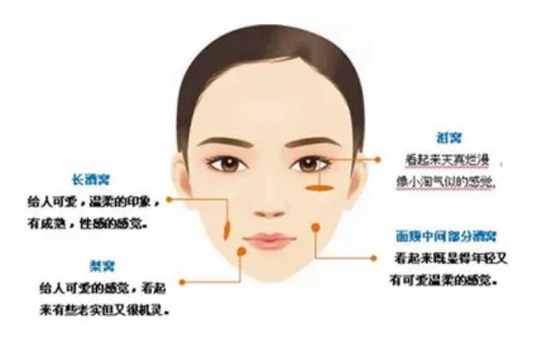 人造酒窩能保持多久 人造酒窩不笑會(huì)有窩嗎